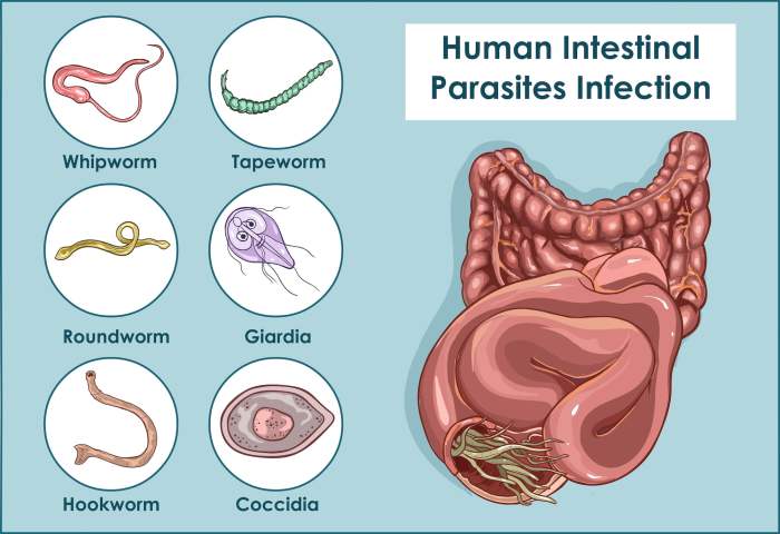 Would i be over sharing if i told you i have worms