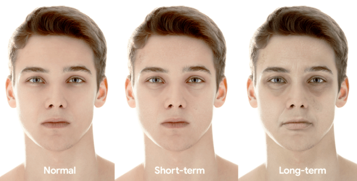 What lack of sleep can do to your face