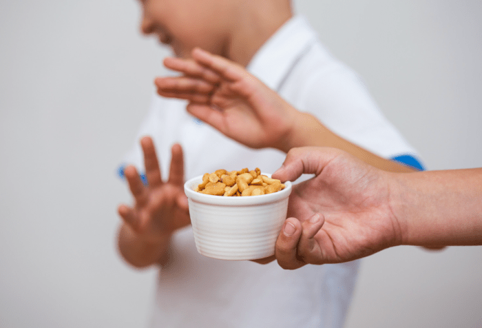 Food allergies are no joke tips to keep your children safe