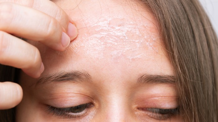 Recipe for split ends and dry skin