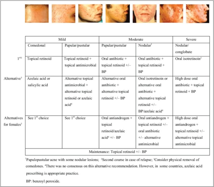Control over acne