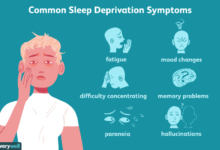 What lack of sleep can do to your face